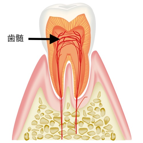 歯の神経って大切なの？